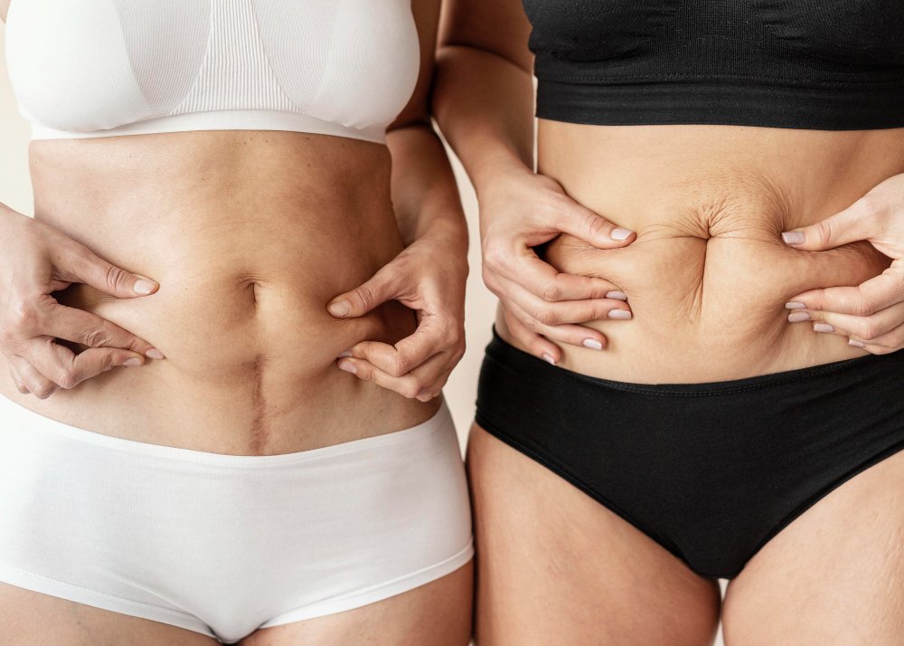fat loss fat burners